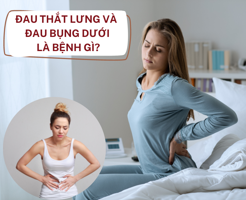 11 Nguyên nhân gây cơn đau thắt lưng và bụng dưới ở phụ nữ
